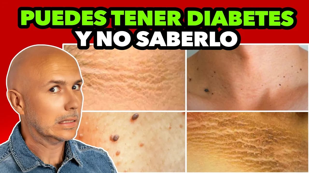¿Manchas En El Cuello y Axilas? SIGNOS Silenciosos De PREDIABETES Que NO CONOCÍAS