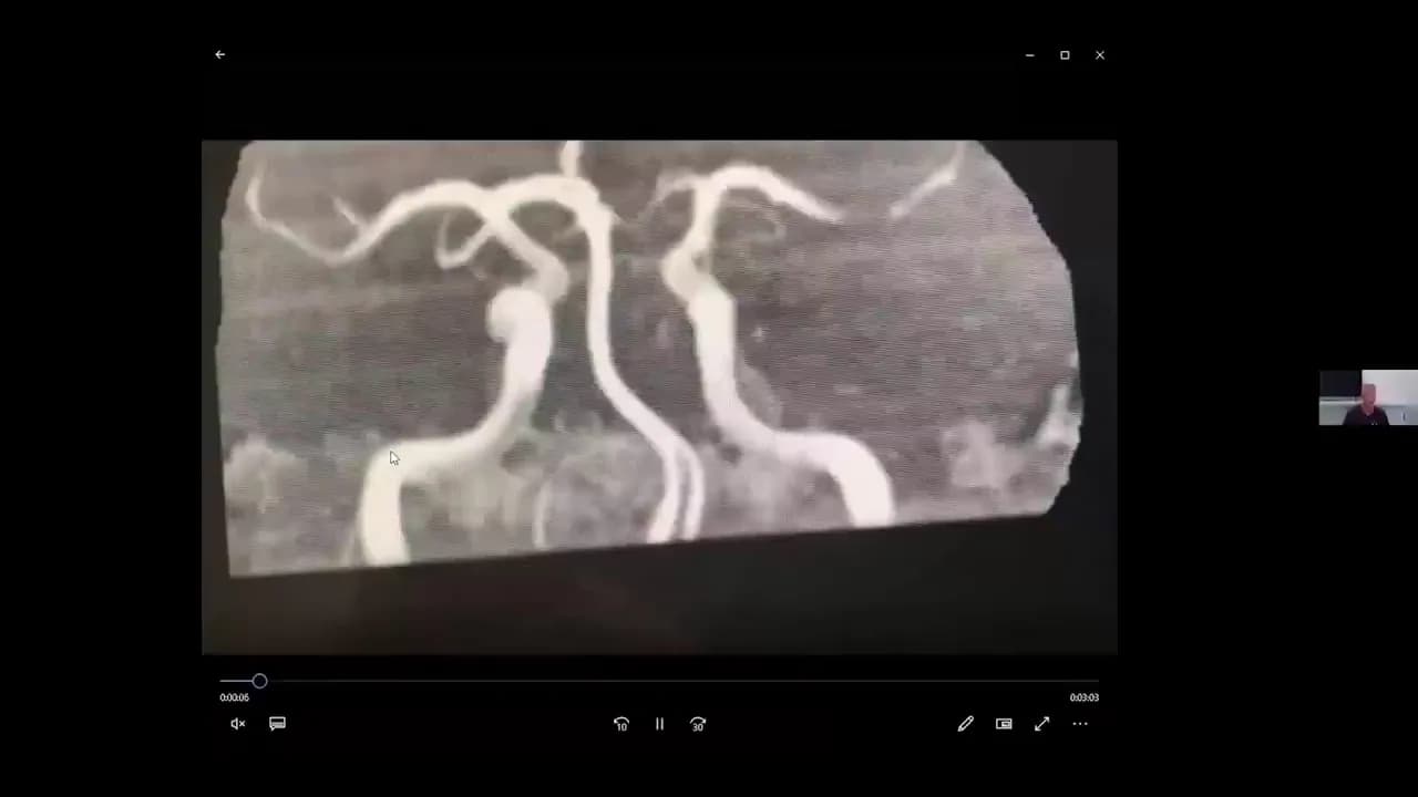 Can an Animal-Based Diet reverse heart disease and diabetes With Sean O’Mara, MD. - 1of2